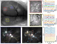 澳门金沙网址具有高时空分辨率的大尺度生物活动显微成像对于系统生物学研究